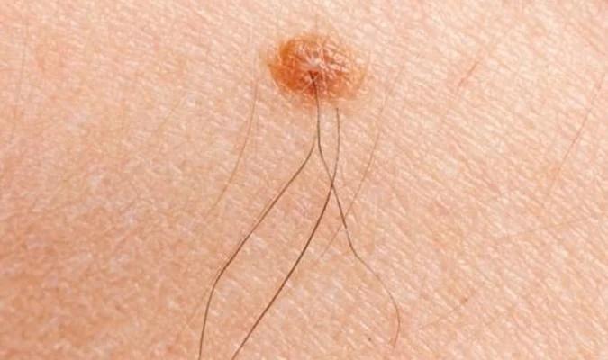 Lông mọc ở 5 vị trí báo hỷ tín tới nhà, niềm vui tới tấp viên mãn-1