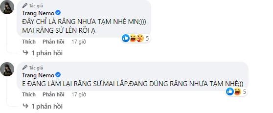 Trang Nemo nói chuyện rớt cả răng, anh xã phản ứng phũ-2