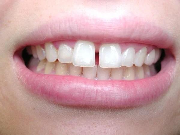5 nét tướng phụ nữ tiêu tiền như nước, cả đời chẳng để ra đồng nào-3