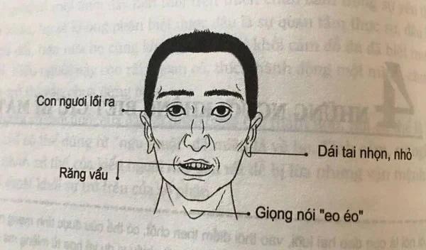 Người lông mày thô rậm tràn xuống bờ mi chớ dại đến gần, vì sao?-2