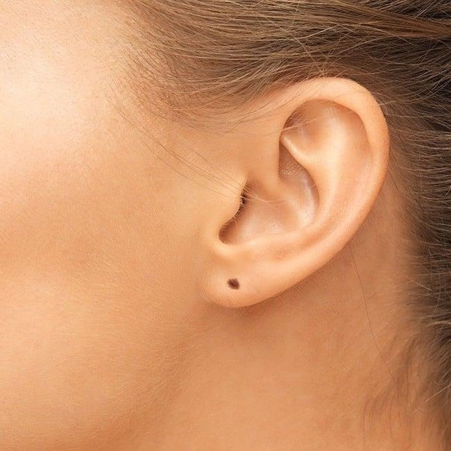 9 nốt ruồi tài lộc quý hơn vàng-1