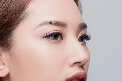 9 nốt ruồi tài lộc quý hơn vàng-3