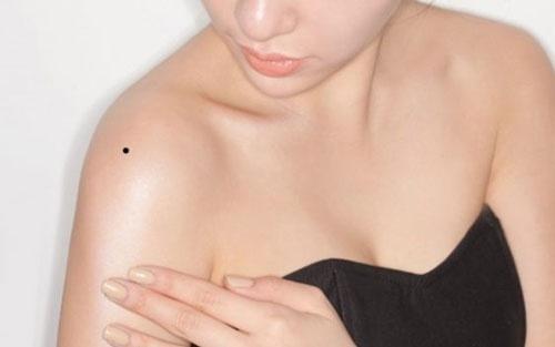 Nốt ruồi trên vai gánh vác cuộc đời: Thực tế chứng minh ra sao?-2