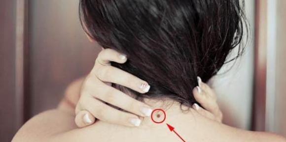 nốt ruồi, tướng số