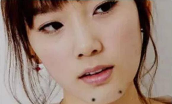 nốt ruồi, nốt ruồi phú quý