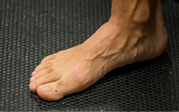 Nhân tướng học, tướng nốt ruồi, nốt ruồi ở chân