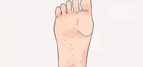 nốt ruồi, xem tướng nốt ruồi, nốt ruồi giàu sang