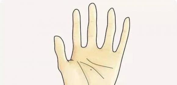 nốt ruồi, xem tướng nốt ruồi, nốt ruồi giàu sang