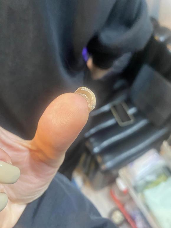làm nail, nail đẹp, làm nail bị hỏng