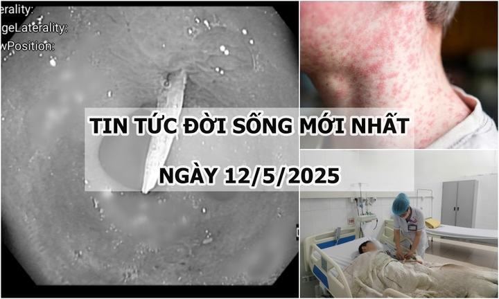 Tin tức đời sống 12/5: Nguyên nhân khiến cụ bà đau bụng âm ỉ suốt nhiều ngày