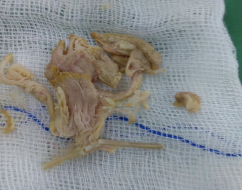 Nhiều mảnh cơ và xương gà dài khoảng 4cm. Ảnh: BVCC.