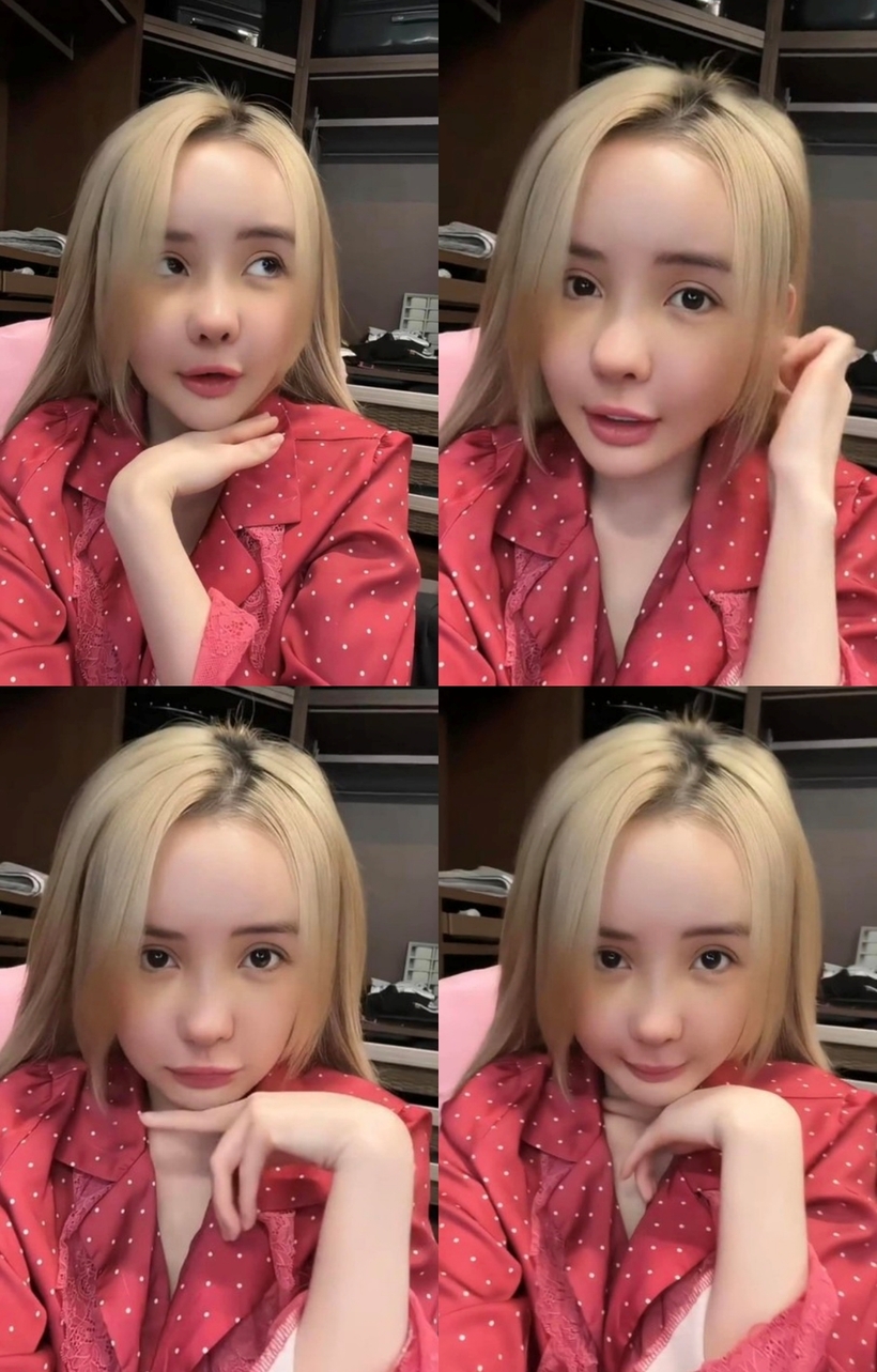 Nhan sắc sau phẫu thuật của Ngân 98