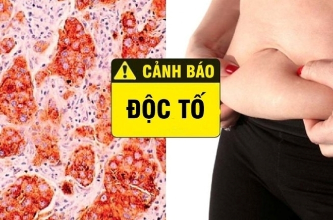 Nhận biết sớm các dấu hiệu cơ thể chứa độc tố là vô cùng quan trọng.