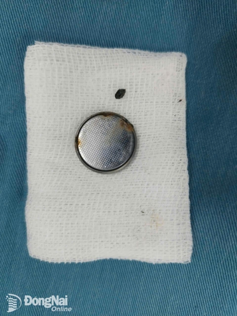 Viên pin được gắp ra ngoài. Ảnh: Báo Đồng Nai