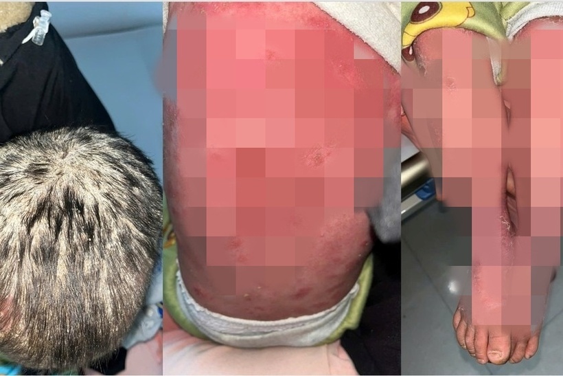 Tình trạng của bệnh nhi. Ảnh: Pháp luật Việt Nam