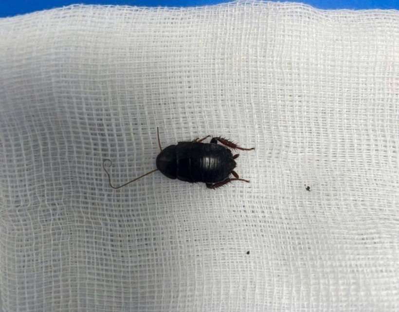 Con gián được lấy ra khỏi tai bệnh nhân. Ảnh: Gia Đình & Xã Hội