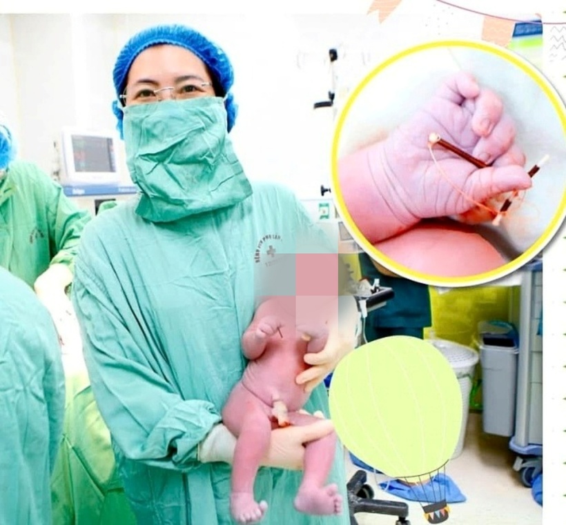 Bác sĩ bế em bé vừa chào đời cùng với chiếc vòng tránh thai của mẹ. Ảnh: VTC News
