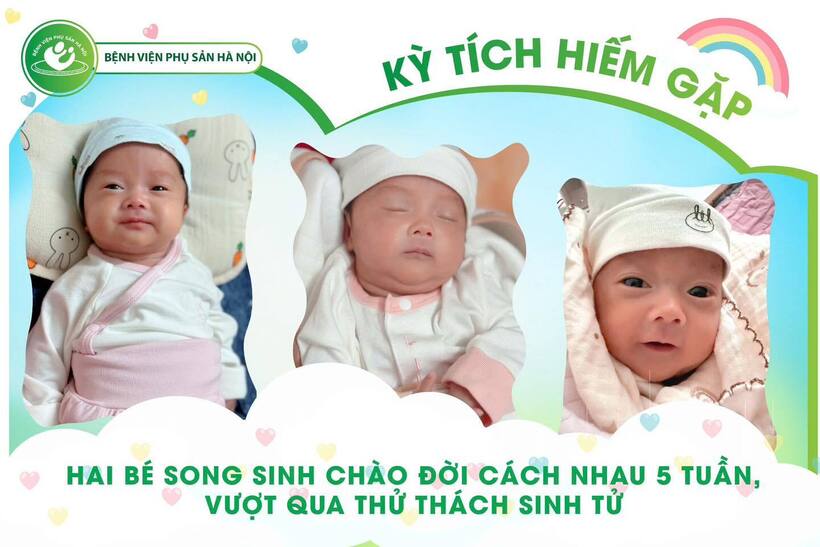 Kỳ diệu hành trình của hai bé song sinh chào đời cách nhau 5 tuần. Ảnh: Bệnh viện Phụ sản Hà Nội