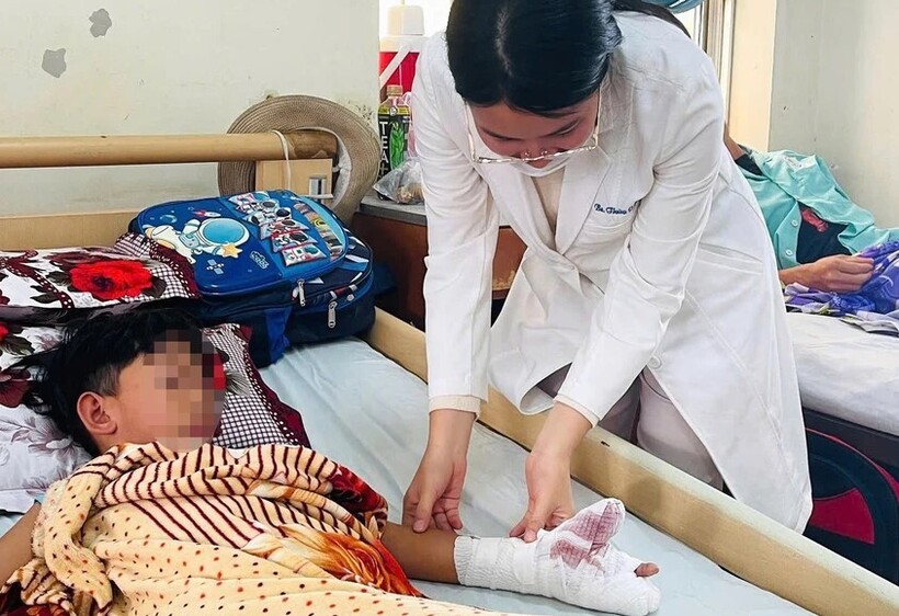 Em N đã được các bác sĩ cắt lọc, khâu mỏm cụt, khâu vết thương, kết hợp xương. Ảnh: PLO.
