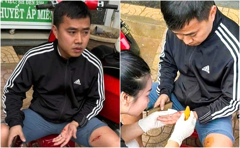 Anh Nguyễn Thành Đạt, cán bộ Văn phòng HĐND và UBND TP Buôn Ma Thuột, bị thương sau khi giải cứu 2 cháu nhỏ. (Ảnh: Dân trí, Tuổi trẻ)