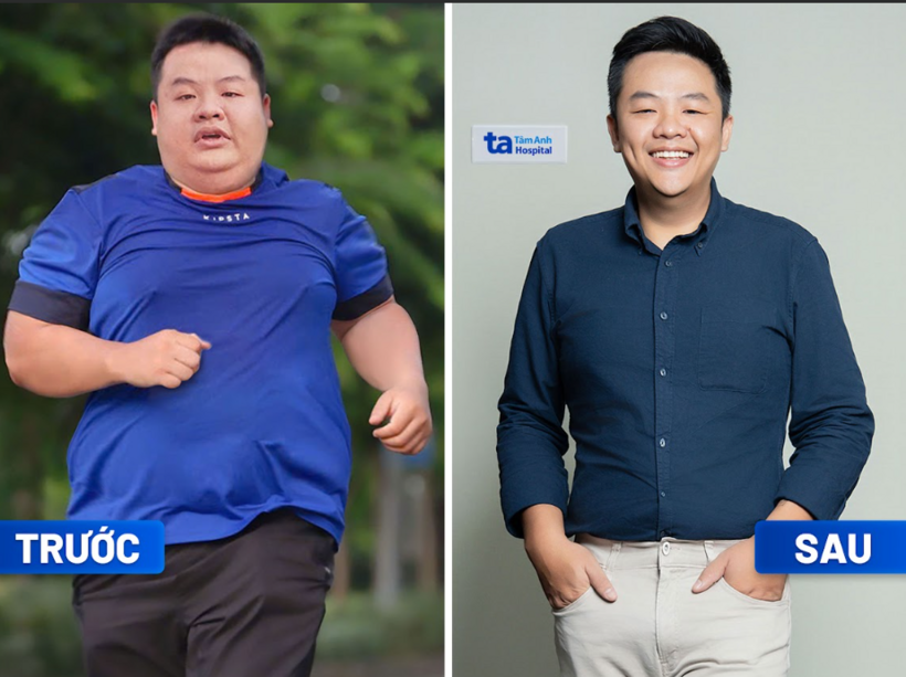 Phối hợp đa mô thức cho hiệu quả giảm cân hiệu quả, an toàn và duy trì kết quả bền vững. Anh Phạm Quốc Tuấn giảm 9kg trong 3 tháng, không còn uống thuốc, hết đau khớp. Ảnh: BVĐK Tâm Anh