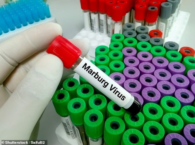 Virus Marburg là một loại vi khuẩn có độc lực cao, gây sốt nặng và thường kèm theo các biểu hiện như xuất huyết và suy nội tạng. Ảnh minh họa: Shutterstock