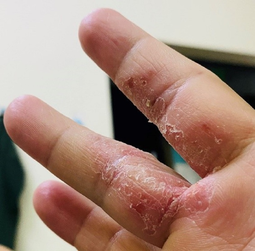 Phương thuốc nổi tiếng trị bệnh ngoài da–Bảo Thanh Đường - 1