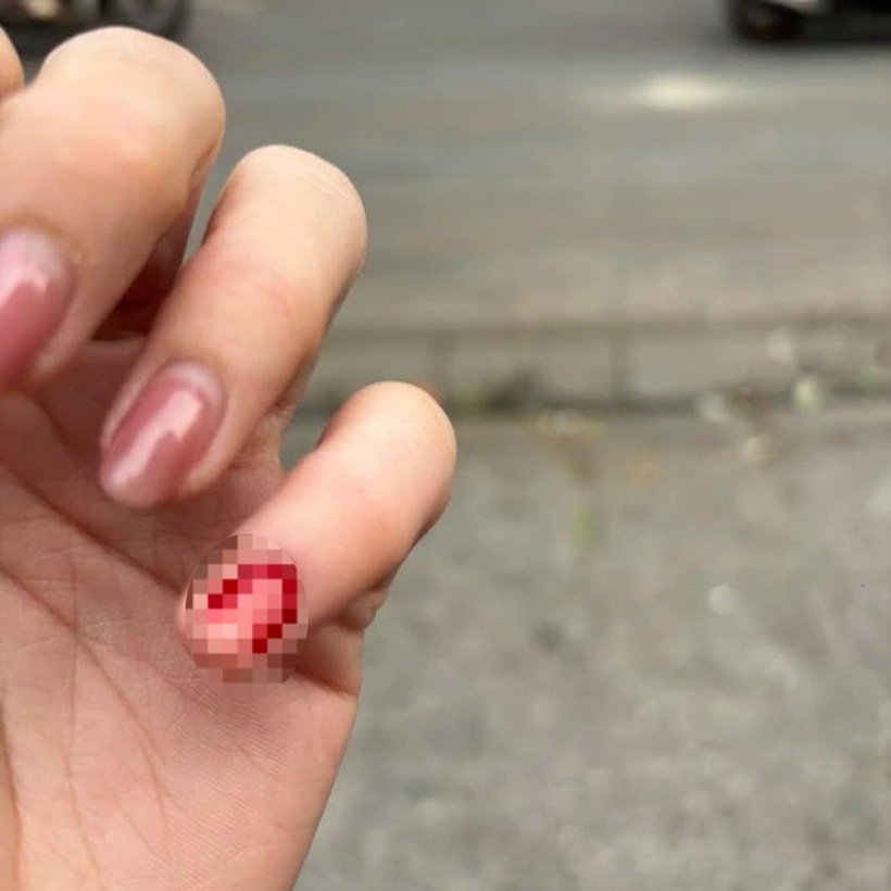 Nữ khách chia sẻ bị nhân viên bẻ gãy móng tay. Ảnh: NVCC