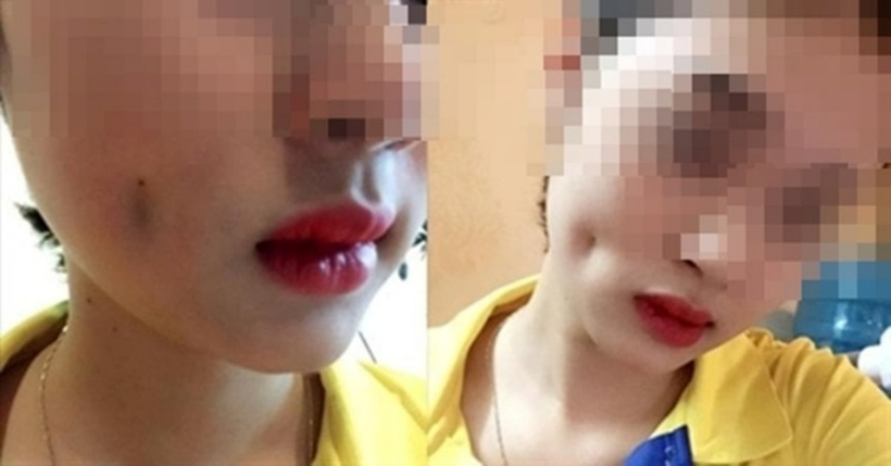 Nhiều nngười bị biến chứng nặng chỉ vì tạo má lúm đồng tiền "hợp phong thủy". Ảnh: phunulife.