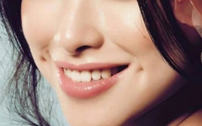Má lúm đồng tiền tượng trưng cho sự may mắn, tài lộc, và đó là nét đẹp dễ thương và duyên ngầm cho người sở hữu.