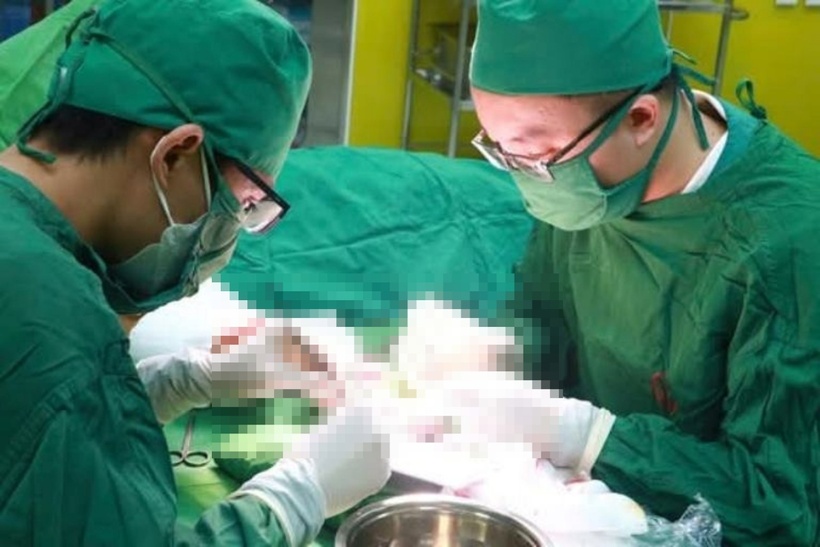 Các bác sĩ tiến hành phẫu thuật ghép da tay cho bệnh nhân. Ảnh: Sức Khỏe & Đời Sống