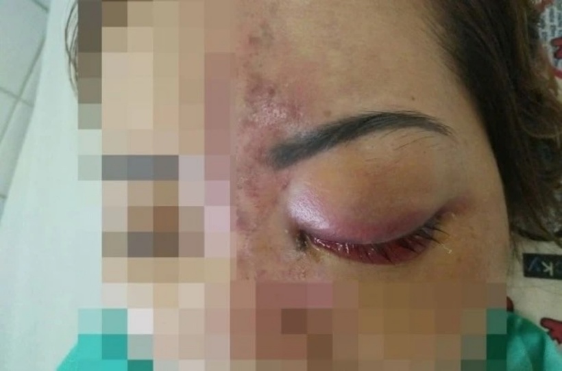 Nhiều người gặp họa vì ham hố độn trán phong thủy. Ảnh minh họa: Infornet.