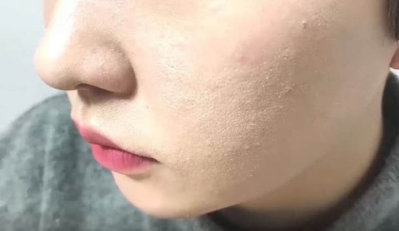 “Cấp cứu” làn da trong những ngày Tết. Ảnh minh họa