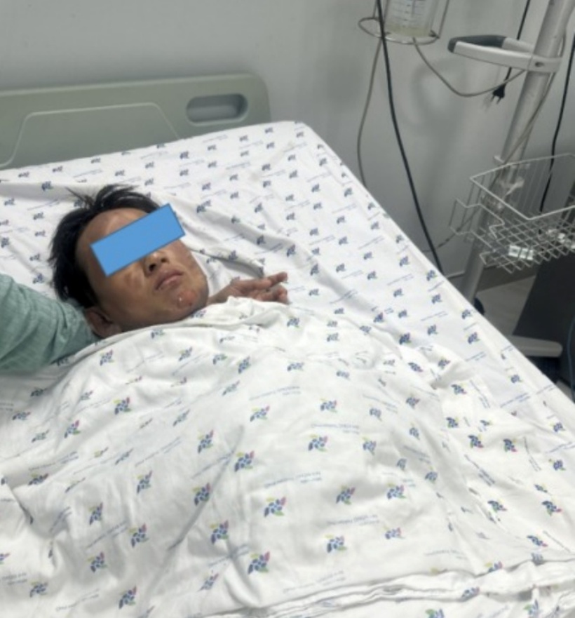 Đốt cồn với lúa làm cốm nổ, bé trai 12 tuổi bỏng nặng. Ảnh: BVCC.