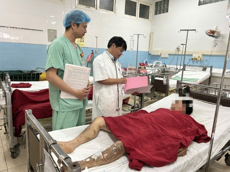 Các nạn nhân đã được chuyển đến Bệnh viện Trung ương Huế điều trị kịp thời. Ảnh: Báo Công an Nhân dân.