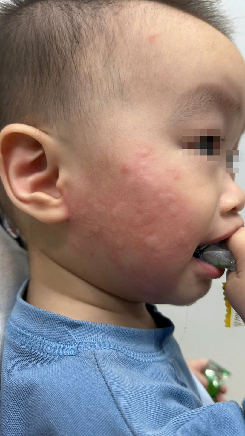 Nhiều trẻ em cũng gặp trường hợp tương tự. Ảnh: BSCC