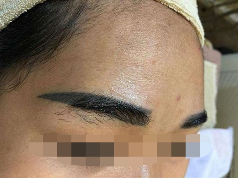 Những khuyết điểm trên khuôn mặt luôn là điều mà thầy tướng lợi dụng để "phán bừa". Ảnh minh họa.