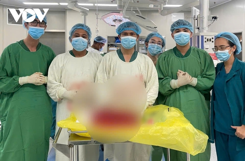 Các bác sĩ đã lấy thành công khối u sau phúc mạc nặng 8 kg ra khỏi cơ thể bệnh nhân. Ảnh: VOV