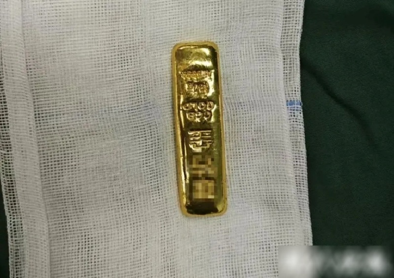 Ca can thiệp thành công chỉ trong nửa giờ, lấy ra một thỏi vàng nặng 100 gam còn nguyên vẹn. Ảnh: QQ.