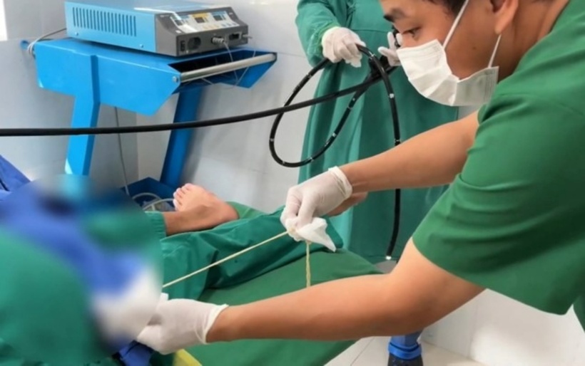 Các bác sĩ tiến hành thủ thuật kéo con sán ra ngoài. Ảnh: Tiền Phong