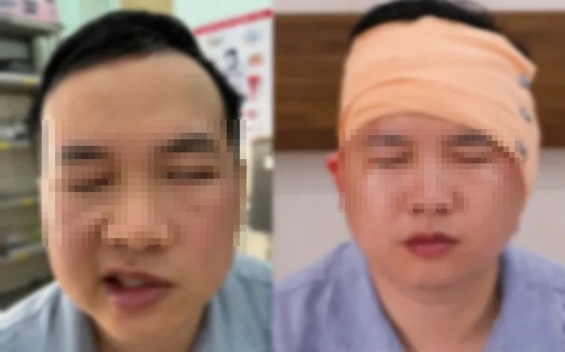 Sau phẫu thuật 3 ngày, cơ mặt bệnh nhân đã cân đối trở lại. Ảnh: Thời báo VTV