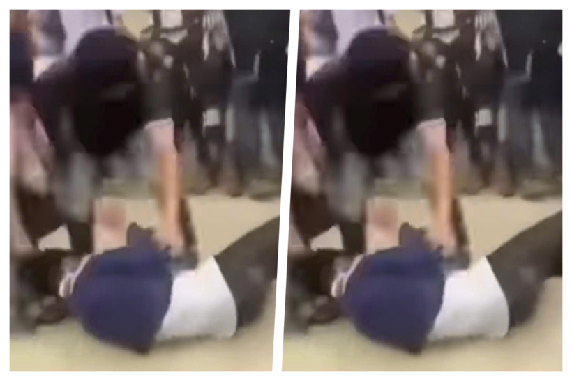 Nam sinh lớp 7 bị nhóm bạn đánh hội đồng sau giờ tan học. Ảnh: Sức khỏe & Đời sống