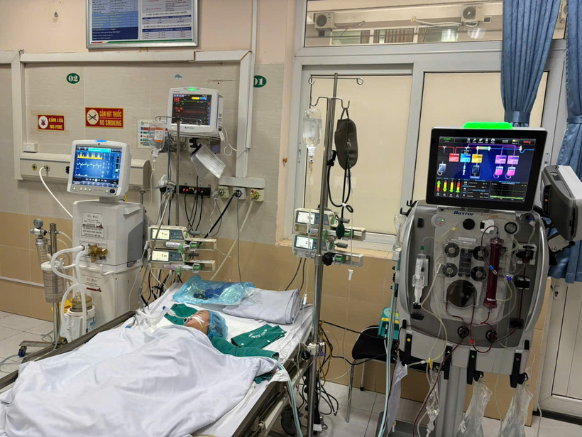 40h lọc máu cứu sống bệnh nhi mắc tay chân miệng. Ảnh: BVCC