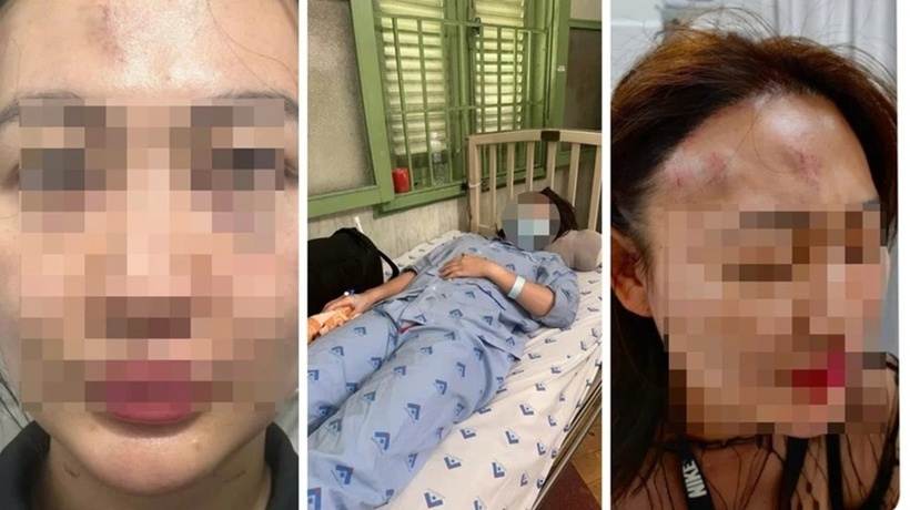 Vụ việc khiến chị N. bị thương tật 23%. Ảnh: PLO.