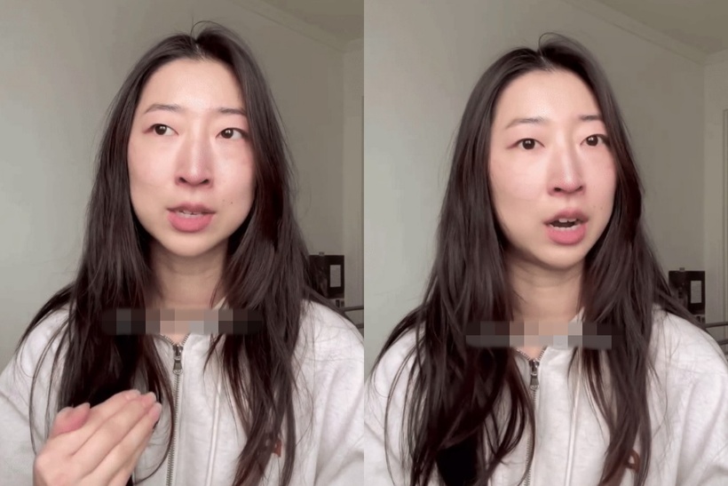 Esther Jeong 29 tuổi, một nghệ nhân làm gốm đã đến Hàn Quốc để tiêm chất tăng sinh collagen Juvelook Volume. Ảnh: @estherjeong.