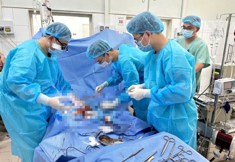 Các y bác sĩ Bệnh viện Trung ương Huế sử dụng kỹ thuật ECMO cứu sống bệnh nhi bị sốc tim. Ảnh: Giáo Dục và Thời Đại