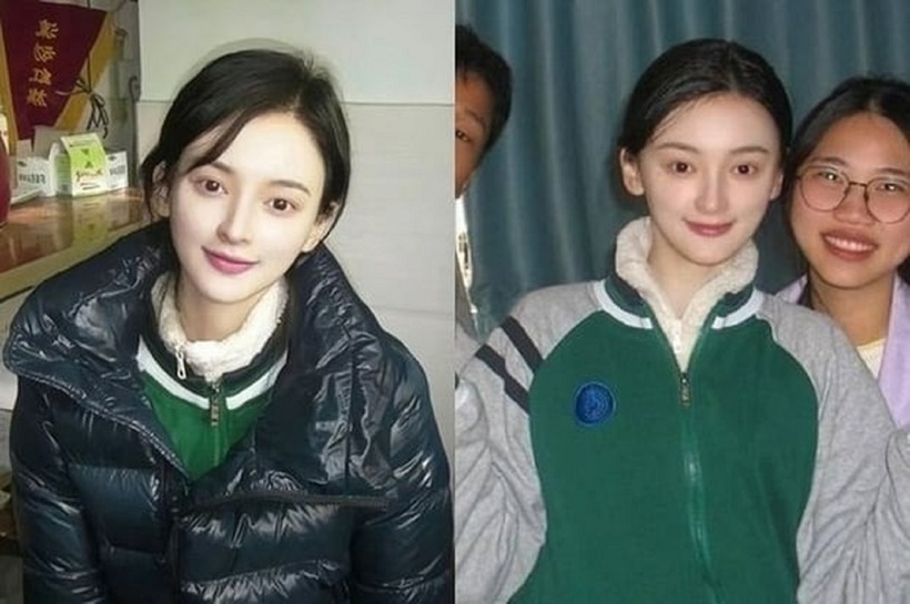 Chenyue thừa nhận đã thực hiện một số tiểu phẫu thẩm mỹ nhỏ như cắt mí, nâng mũi, tiêm filler má và cấy tóc. Ảnh: Weibo