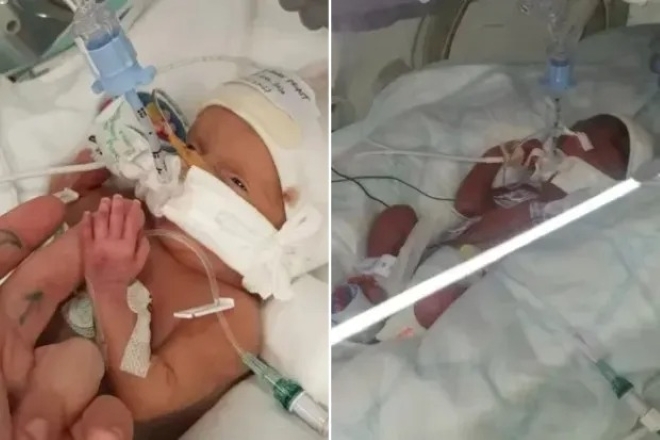 Hai bé sơ sinh tử vong do bị tiêm nhầm thuốc. Ảnh: The Sun