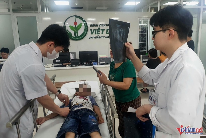 Bé trai được đưa đến Bệnh viện Hữu nghị Việt Đức cấp cứu sáng 4/5. Ảnh: VietNamNet