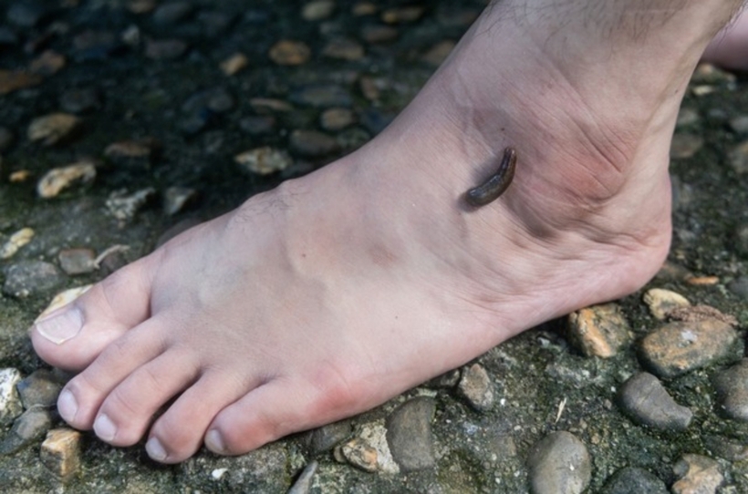Nam bệnh nhân bị nhiễm trùng huyết sau khi bị một loại sinh vật giống con vắt cắn vào đầu ngón chân. Ảnh minh họa: Người Lao Động